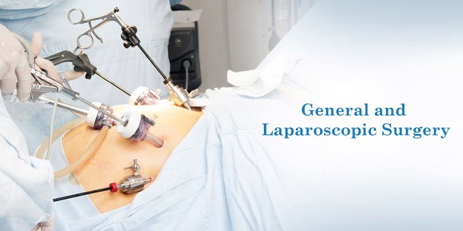 Laparoscopic